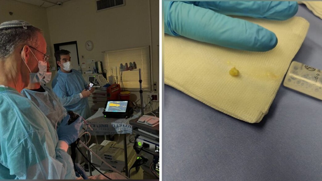 הפרוצדורה בשעצ