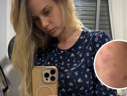 "הכאב מזעזע": בר זומר מתפרקת בדמעות וחושפת שאובחנה בשלבקת חוגרת