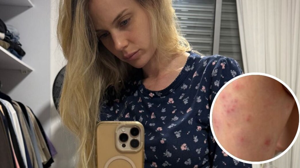 בר זומר: "עוברת תקופה שלא נגמרת. שלבקת חוגרת היא תוצאה של הנפש"