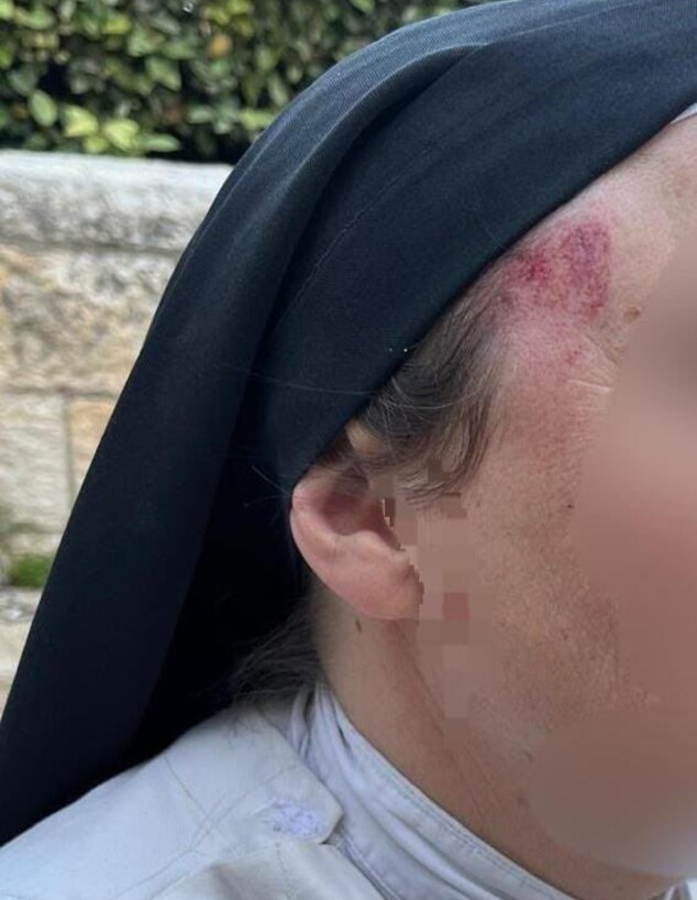 הנזירה שהותקפה ליד כנסיית דורמיציון