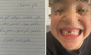 הילד בלע את השן (צילום: פרטי)