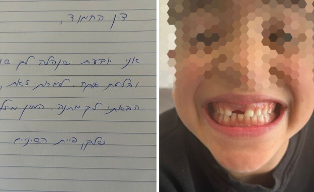 הילד בלע את השן (צילום: פרטי)