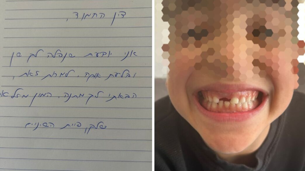 הילד בלע את השן