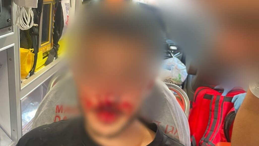 הפצוע שהותקף באצטדיון בלומפילד