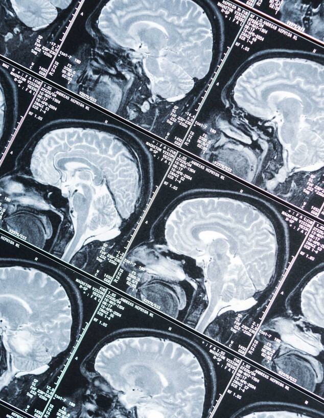 סריקות MRI של מוח אנושי