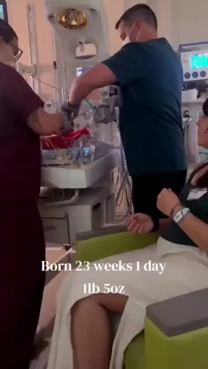 כך נראה תינוק שנולד בשבוע 23, ובמשקל של פחות מ-600 גרם