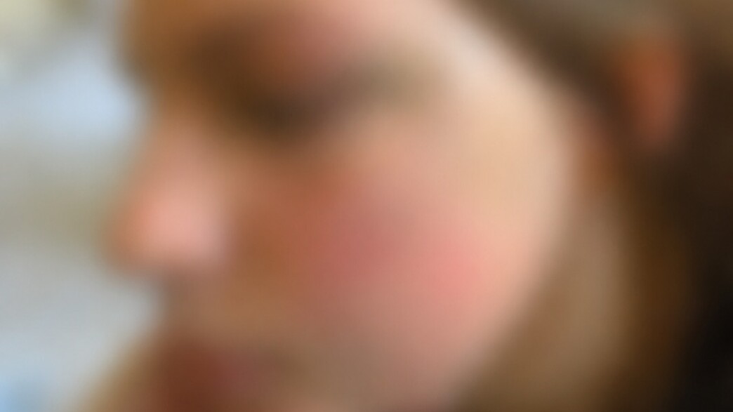 הנערה שהותקפה הנערה שהותקפה