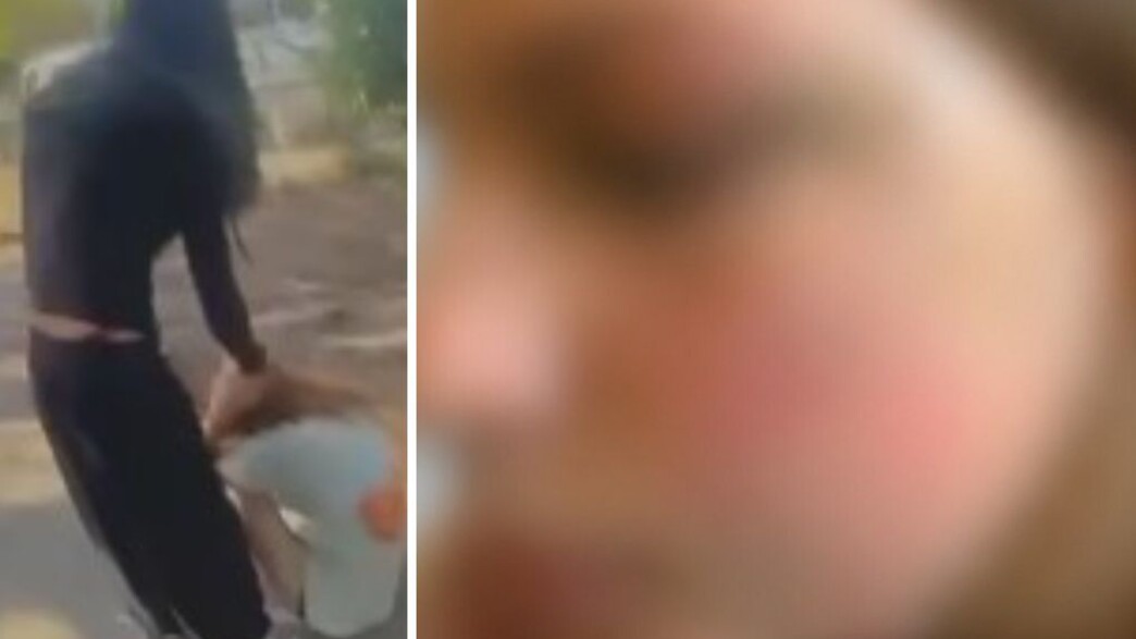 הנערה שהותקפה הנערה שהותקפה