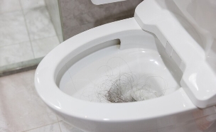 שערות באסלה (צילום: shutterstock_leungchopan)