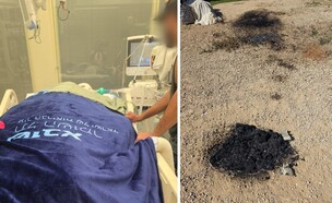 מימין: מקום ההצתה, ר' מאושפז בבית החולים