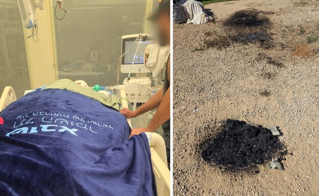 מימין: מקום ההצתה, ר' מאושפז בבית החולים