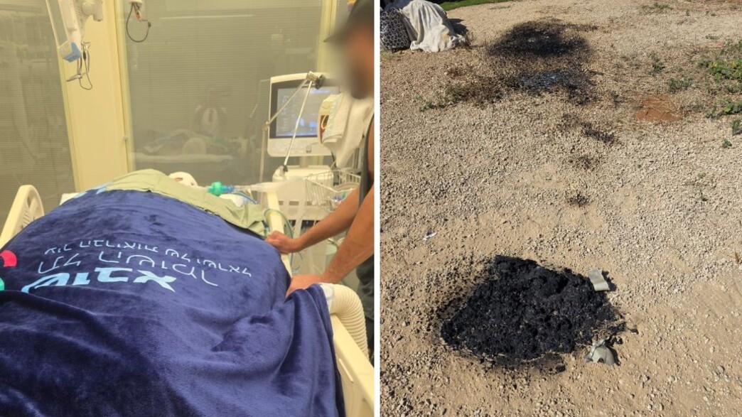 מימין: מקום ההצתה, ר' מאושפז בבית החולים מימין: מקום ההצתה, ר' מאושפז בבית החולים