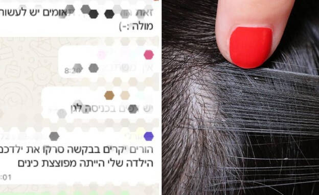כינים