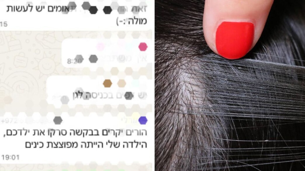 כינים כינים