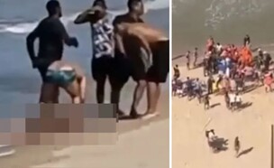 יצא לבלות בחוף הים עם משפחתו – והותקף בידי כריש (צילום: מתוך הרשתות החברתיות לפי סעיף 27א׳ לחוק זכויות יוצרים)
