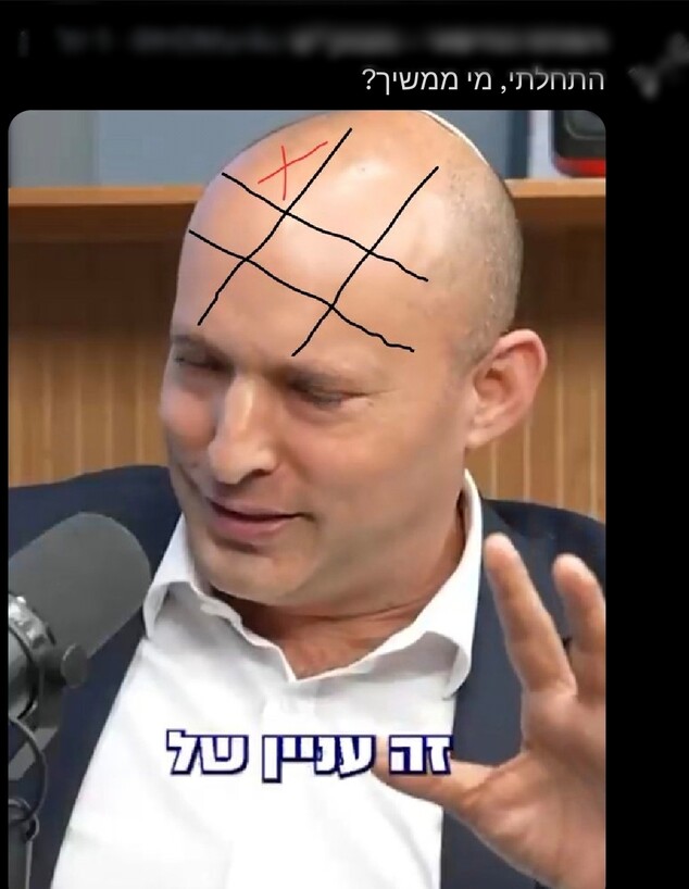 פוסט ההסתה נגד בנט