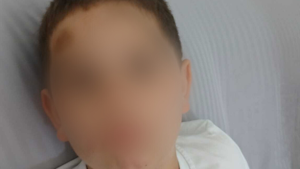 בן ה-6 הוכה באגרופים בגן - האם מאשימה את הצוות במחדל מתמשך