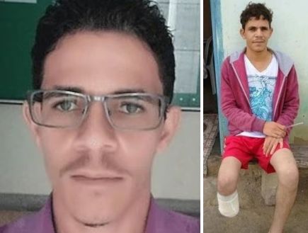 גרם לקטיעת כף רגלו כדי להונות את הביטוח – ונתפס