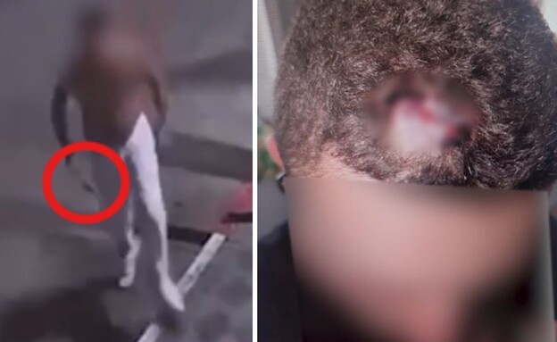 התקיפה בפטיש בנתניה