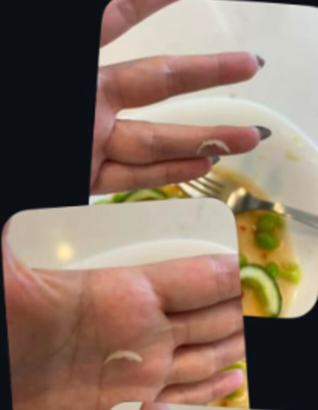 ציפורן שנמצאה בפולי סויה קפואים של רמי לוי