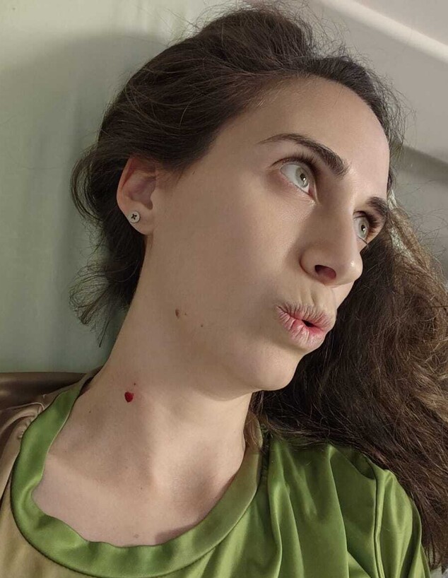 שירה בביופסיה שירה בביופסיה