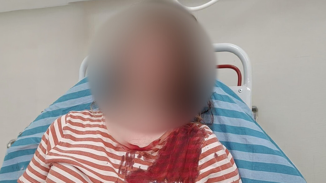 האישה שהותקפה באכזריות לעיני ילדיה