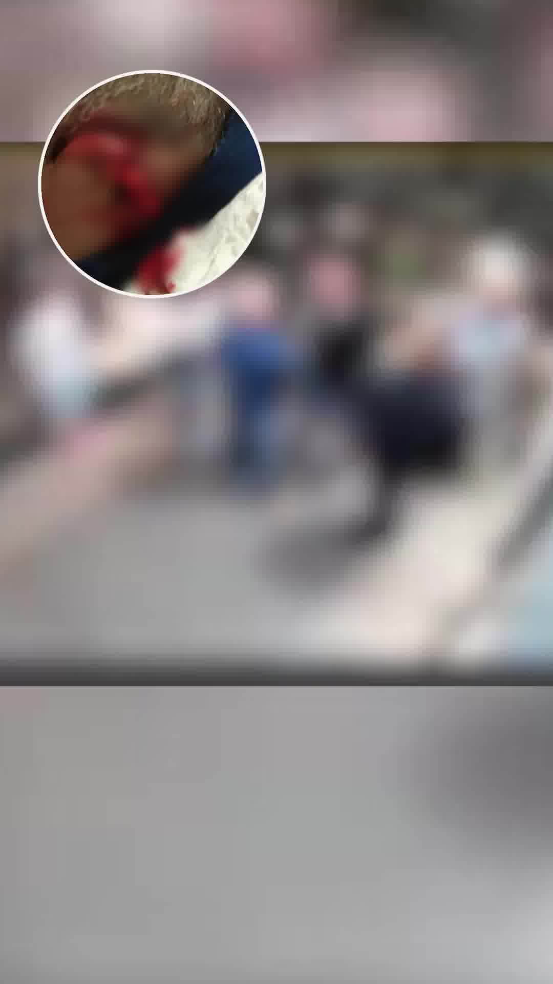 תיעוד: תושב ראשון לציון נשך ותלש חלק מאוזנו של השכן בגלל ריב על אינטרקום בבניין