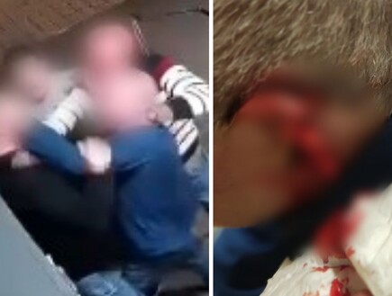 נשך ותלש חלק מאוזנו של השכן בגלל ריב על אינטרקום בבניין