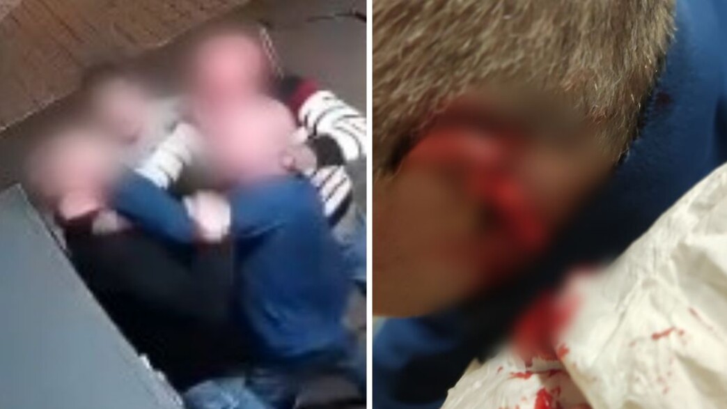 נשך את האוזן של חברו בקטטה נשך את האוזן של חברו בקטטה