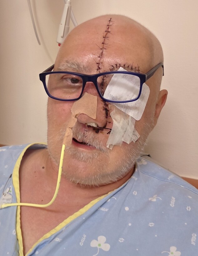 שחזור פניו של רומן שחזור פניו של רומן
