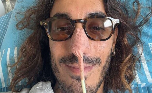 עידו ממון עם צינורית הזנה עידו ממון עם צינורית הזנה