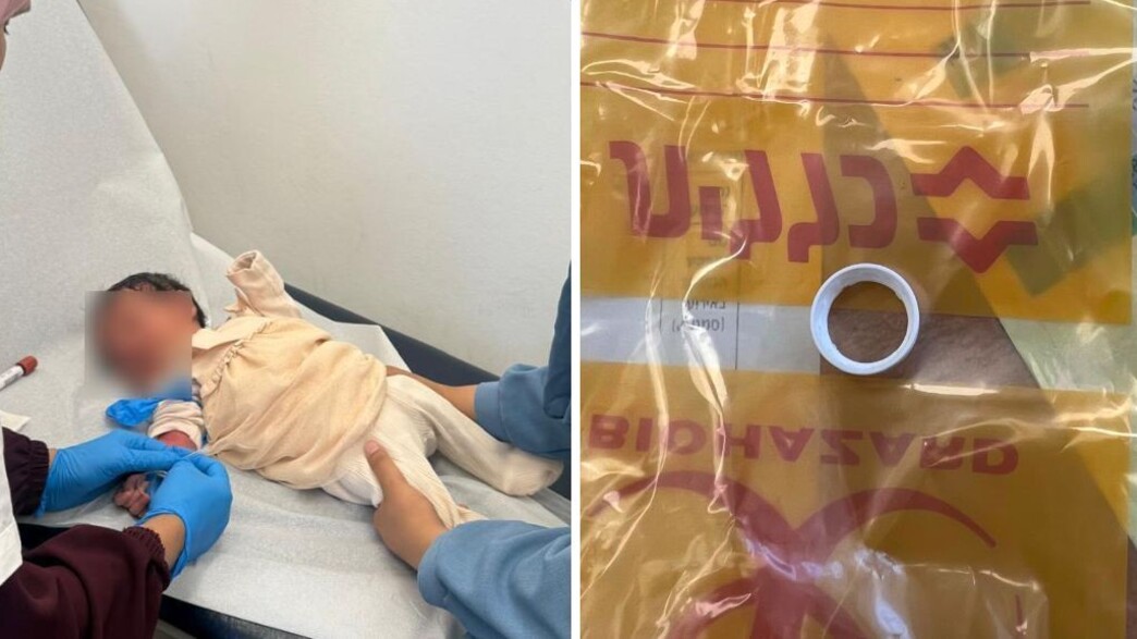 התינוק טופל במרפאה התינוק טופל במרפאה