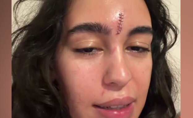 נועם קלינשטיין (צילום: מתוך עמוד האינסטגרם של נועם קלינשטיין)