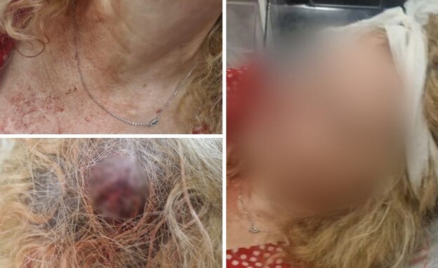 תושבת חדרה שהותקפה