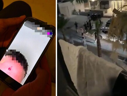 "הם זרקו בקבוקי זכוכית וירו ברובי אוויר, אחד מהישראלים נפצע בראשו"
