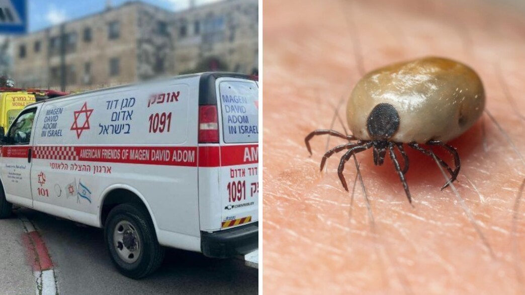 אושפזה בגלל קרצייה