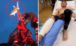 תיעד את הכריש נושך את רגלו – וניצל מהתקיפה (צילום: מתוך הרשתות החברתיות לפי סעיף 27א׳ לחוק זכויות יוצרים)