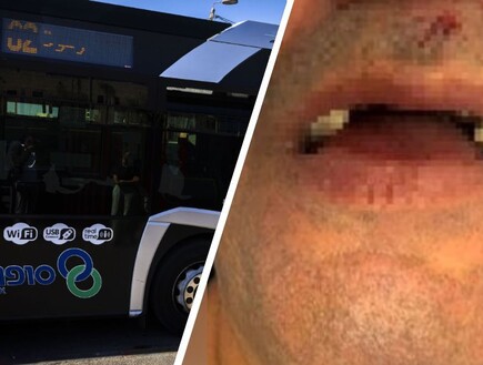צעירים תקפו נהג אוטובוס בירושלים: "איבדתי את ההכרה, נשברו לי 4 שיניים"