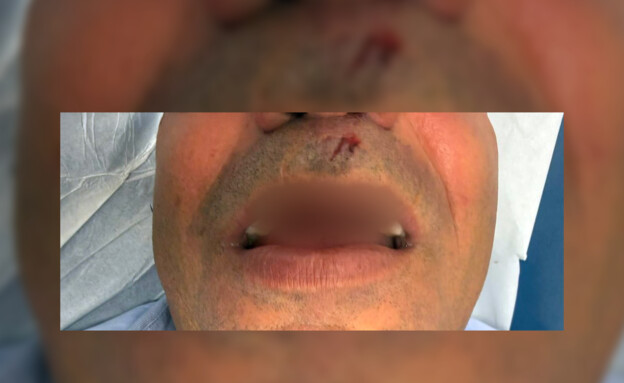 נהג חברת סופברוס שהותקף בירושלים (צילום: כוח לעובדים)