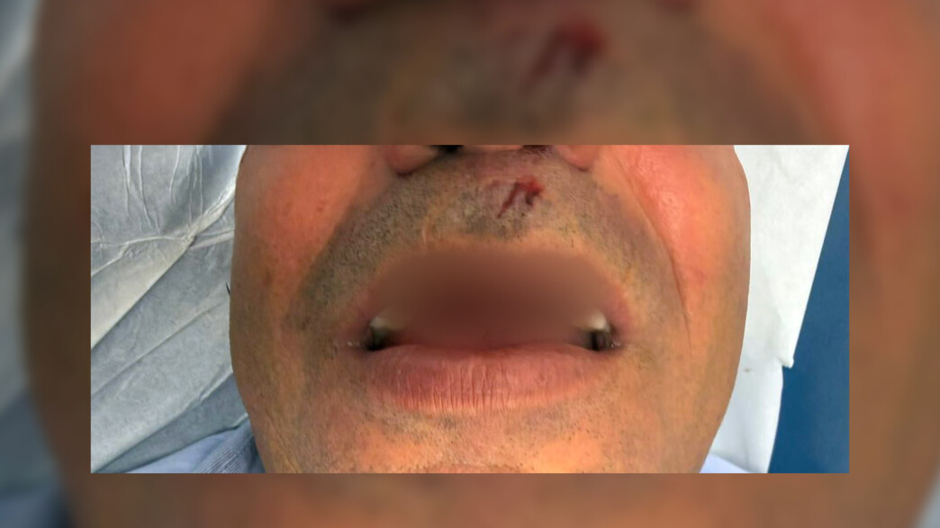 נהג חברת סופברוס שהותקף בירושלים נהג חברת סופברוס שהותקף בירושלים