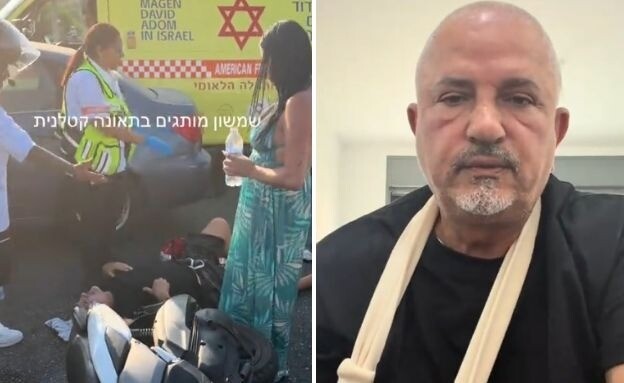 שמשון מותגים נפצע בתאונה