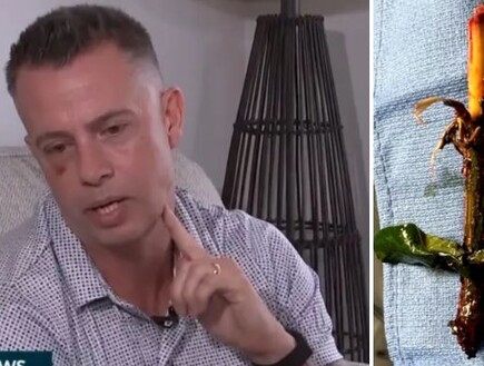 בן 45 נפל מסולם, ענף נתקע לו בפנים - ושרד