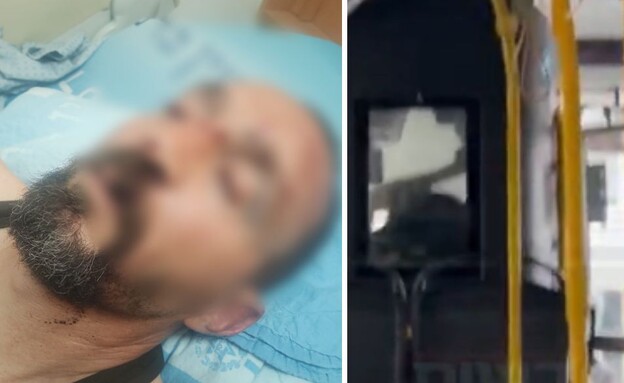 תקיפת הנהג בבית שמש