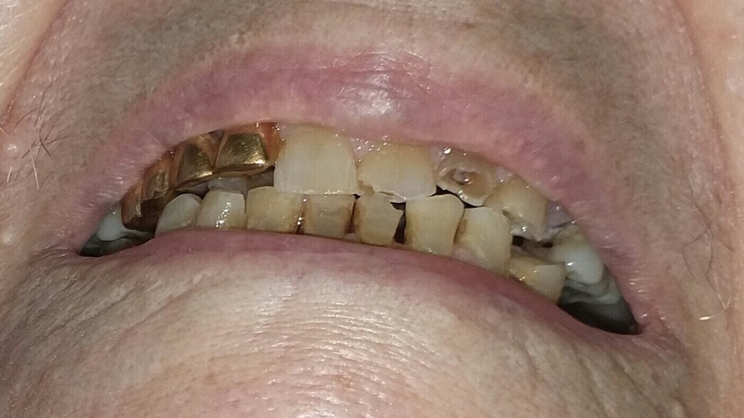 מי עקר שיני זהב מניצולת שואה בבית החולים? מי עקר שיני זהב מניצולת שואה בבית החולים?