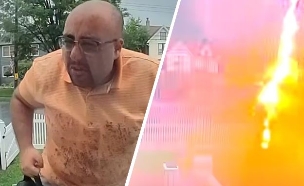 יצא לרופא השיניים – ונפגע מברק (צילום: מתוך הרשתות החברתיות לפי סעיף 27א׳ לחוק זכויות יוצרים)