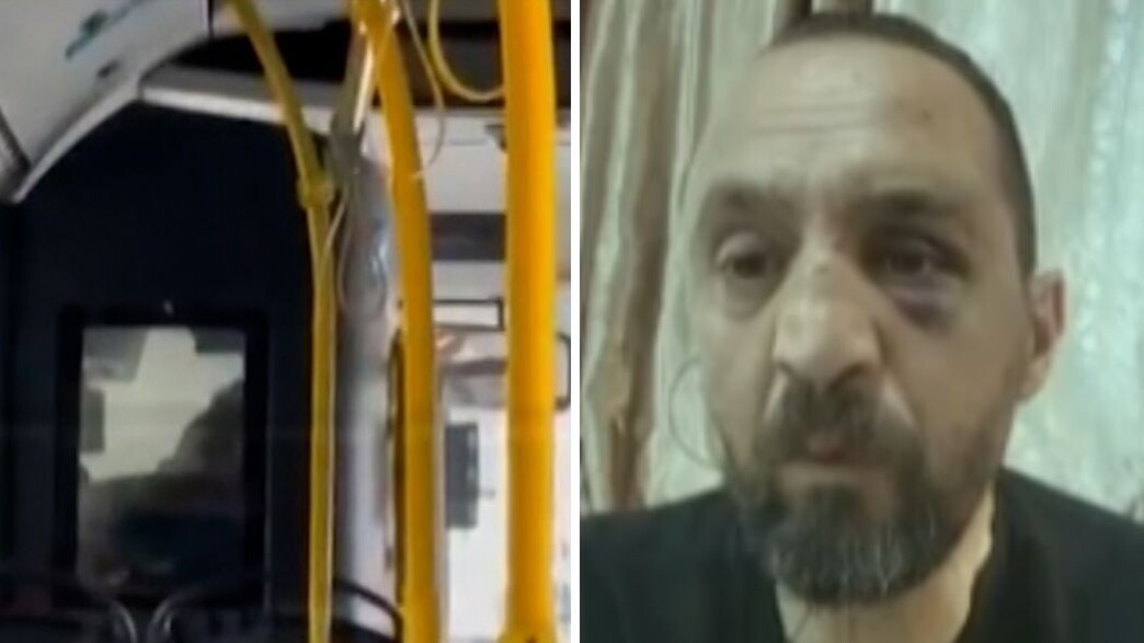 הנהג שהותקף הנהג שהותקף