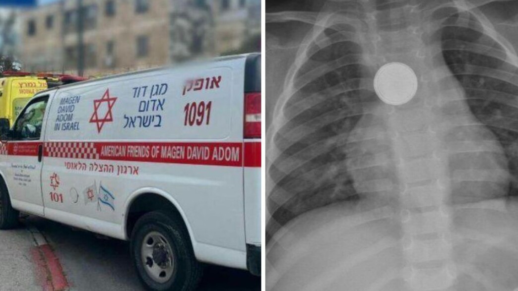 בלע סוללה