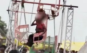 שערה נתפס במתקן – קרקפתה נתלשה (צילום: מתוך הרשתות החברתיות לפי סעיף 27א׳ לחוק זכויות יוצרים)