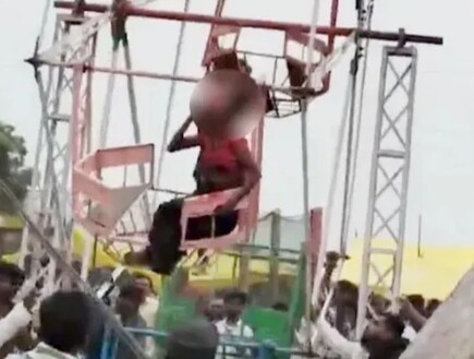 שערה נתפס בגלגל ענק – וחלק מהקרקפת שלה נתלש