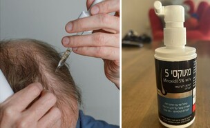 מינוקסי MINOXIDIL (צילום: שאטרסטוק)